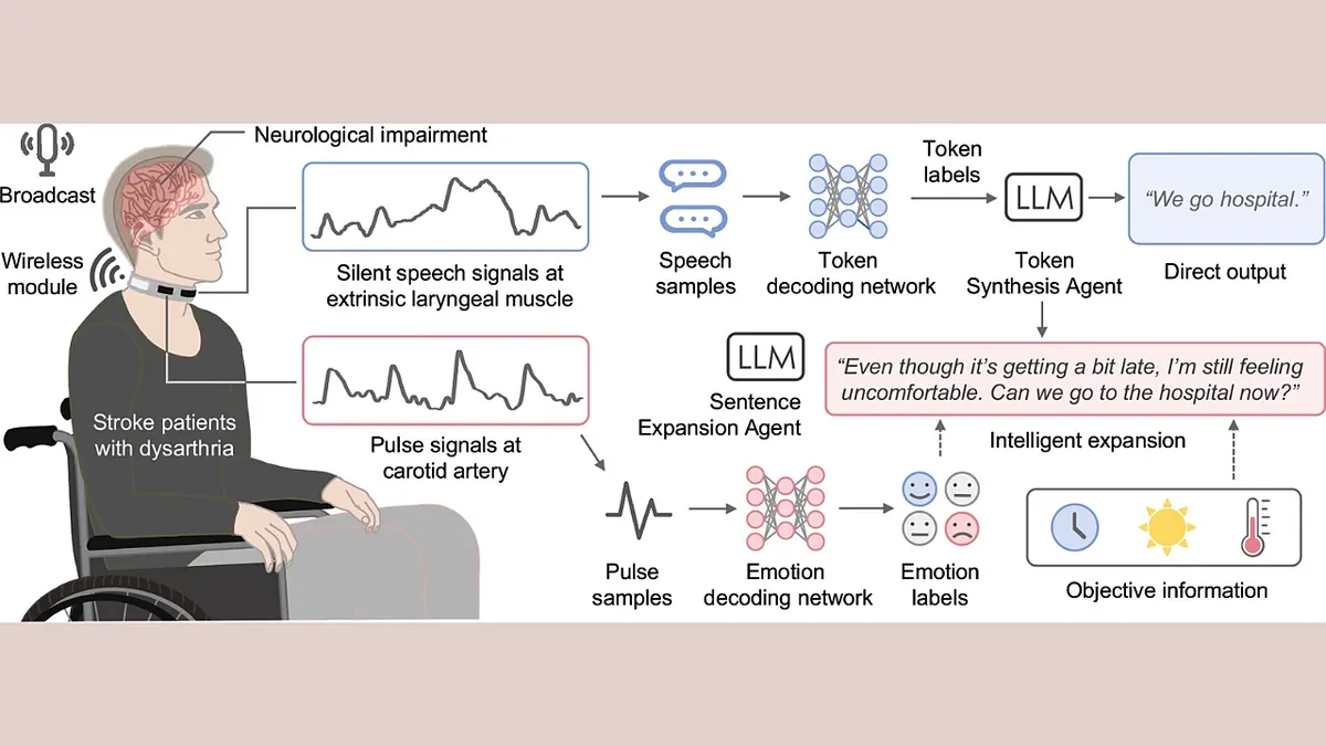 A diagram of how the Revoice device works on a patient